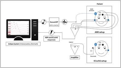 Comparison of auditory brainstem response and electrocochleography to assess the coupling efficiency of active middle ear implants